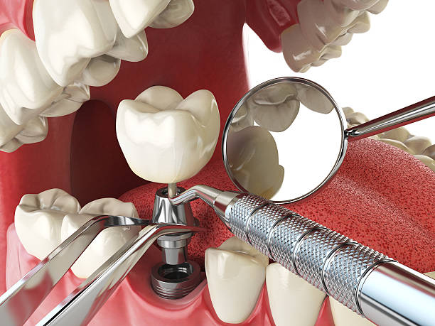 Best Emergency Care for Gum Disease in Fort Mitchell, KY
